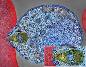 Malaria: Mosquito-borne infectious disease