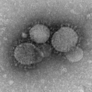 Middle East respiratory syndrome-related coronavirus: Species of virus