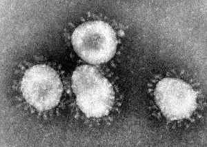 Severe acute respiratory syndrome