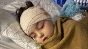 'Rare birthmark caused my child's brain bleed'