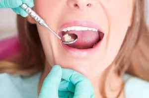 30-minute rule for brushing teeth that protects your enamel and prevents fillings