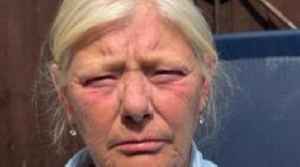 Gran punched by pregnant attacker at funeral disgusted at sentence