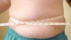 Childhood obesity may not cause 'lifelong risk'