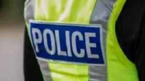 Boy investigated after setting fire to his hands