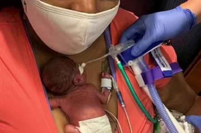 Baby boy born at 21 weeks sets record as world's most premature baby to survive