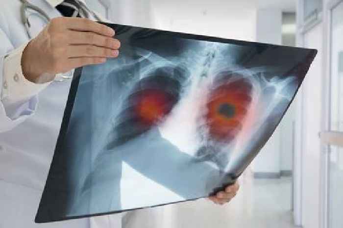 Lung cancer patients to get new drug which can double life-expectancy