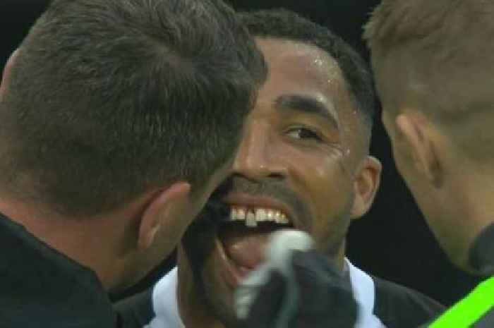 Callum Wilson suffers gruesome tooth injury but carries on playing in Newcastle vs Arsenal