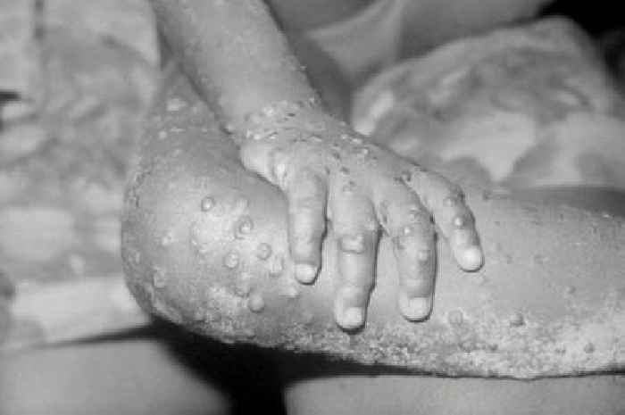 Monkeypox outbreak sparks warning to every British pet owner