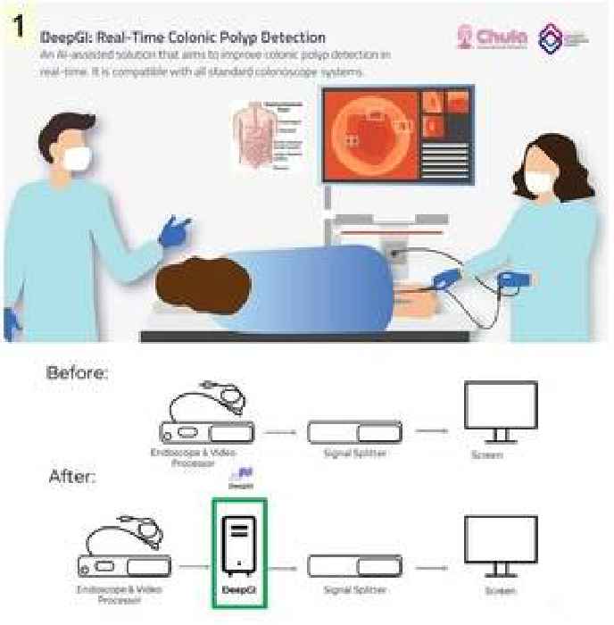 DeepGI AI - A Thai Innovation for the Precision in Colorectal Polyp Detection