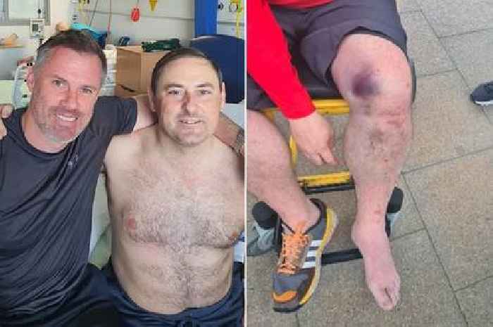 Jamie Carragher surprises Liverpool fan who had knee 'hit with hammer' in Paris