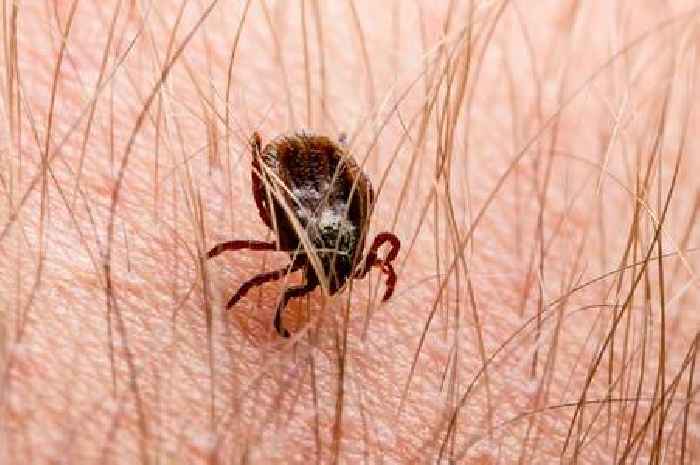 Lyme disease symptoms and how to get tested