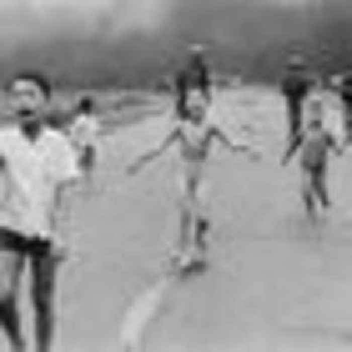 Vietnam 'Napalm Girl' receives final skin treatment in Florida 50 years after being burnt