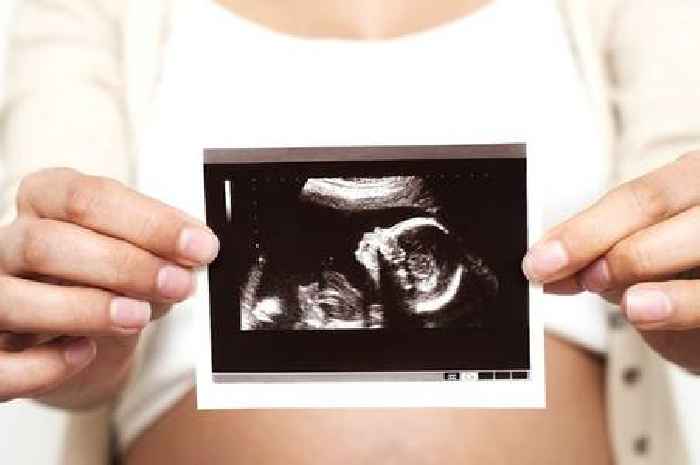 Parents to be charged for baby scan photos at Maidstone and Tunbridge Wells NHS Trust