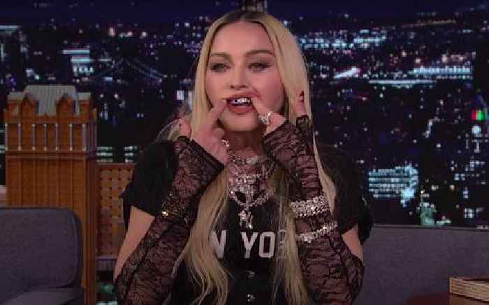 Madonna Discusses Her Grills And Worshipping Kendrick Lamar In Latest Wacky Fallon Interview