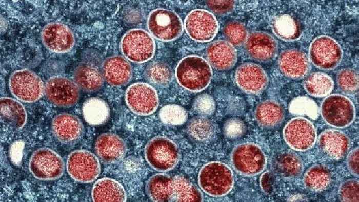 World Health Organization Looks To Change Monkeypox Name