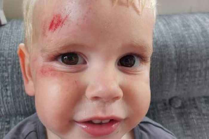 Mum's anger as toddler injured in pedal kart incident at Skipsea Sands caravan park