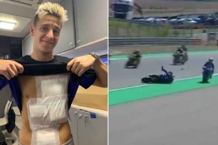 MotoGP star Fabio Quartararo's body almost entirely bandaged after devastating crash