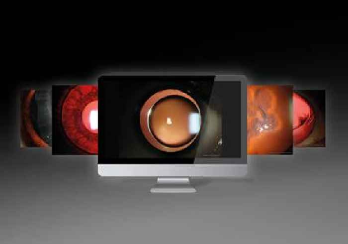  Haag-Streit presents winners of the ‘Haag-Streit Slit Lamp Imaging Competition 2022’