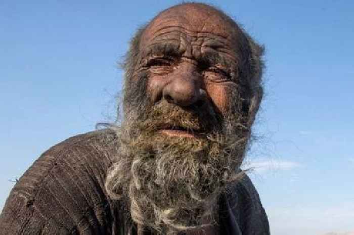 'World's dirtiest man' has first wash in 60 years then dies weeks later