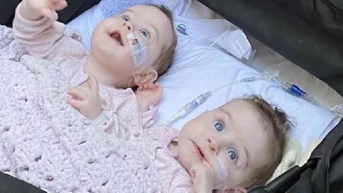 Baby Spice surprises mum of conjoined Co Antrim twins Annabelle and Isabelle with gifts