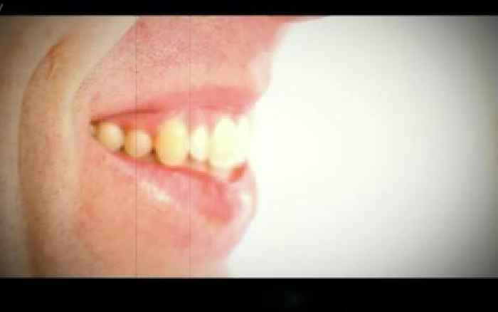 ITV I'm A Celebrity fans horrified by close-up of Matt Hancock's teeth