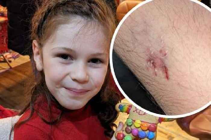 Eight-year-old girl injured by 'aggressive' dog attack while rollerskating