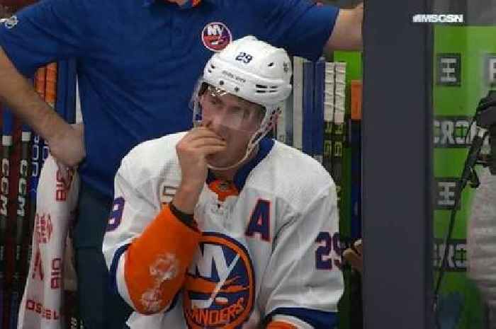 Ice hockey star pulls out his own tooth on bench after brutally taking stick to face