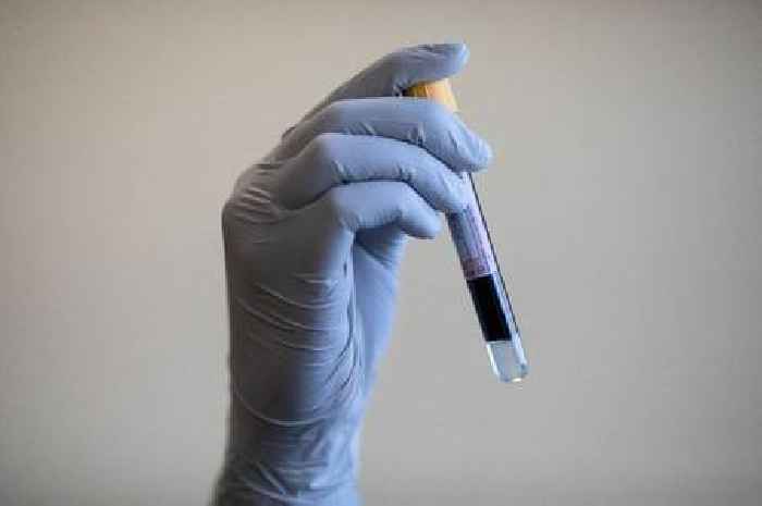 New prostate cancer blood test is 94% accurate, say researchers