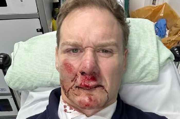 Dan Walker hospitalised after being hit by car while riding his bike