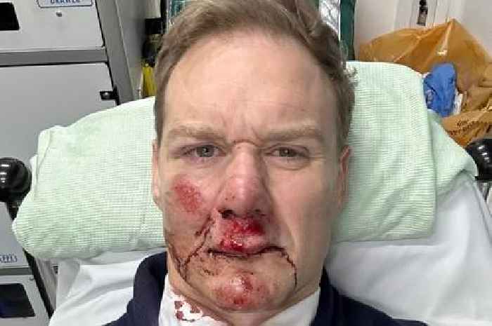 Dan Walker 'glad to be alive' after car smashes into him while riding his bike