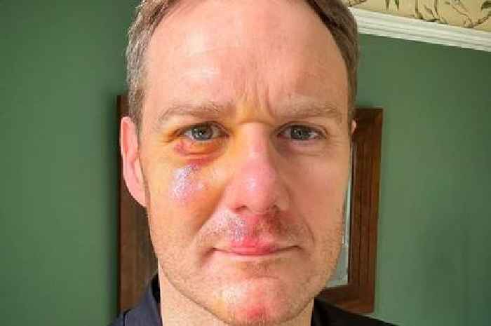 Dan Walker reaches out to horror crash driver to 'resolve it out of court'