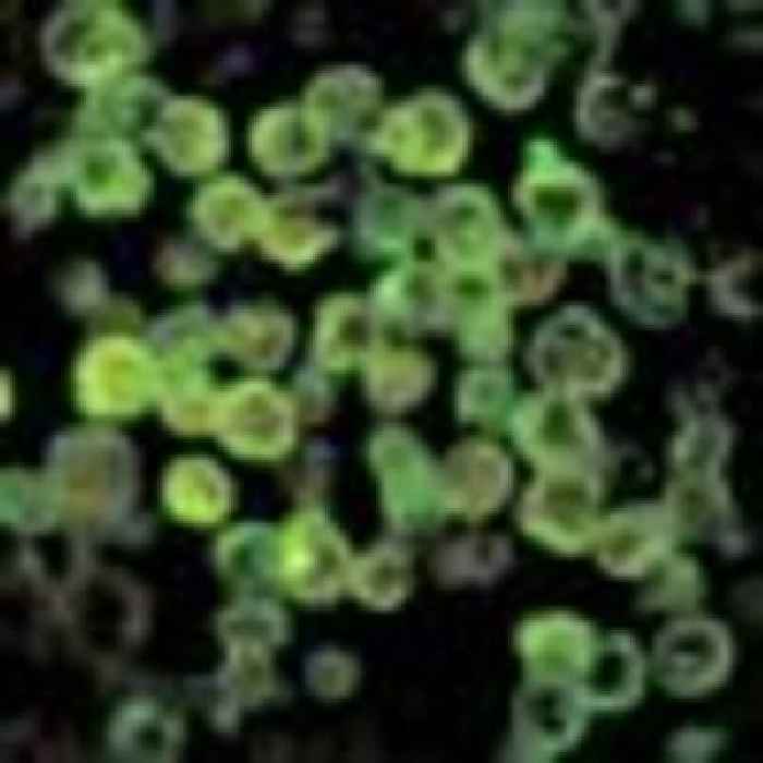 Florida man dies from brain-eating amoeba - possibly after rinsing his nose with tap water