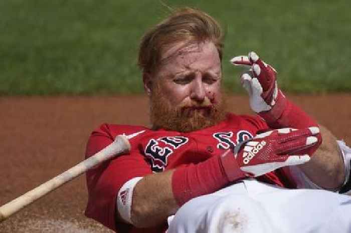 Boston Red Sox star left pouring with blood after taking sickening baseball to the face