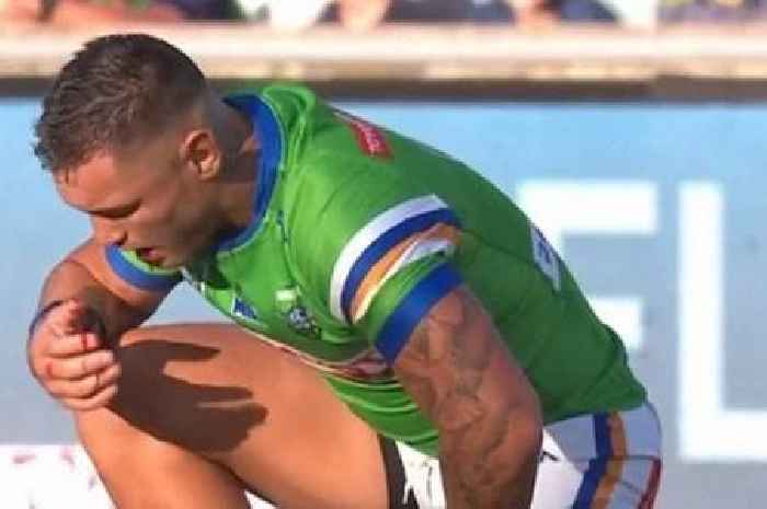 Horror tackle breaks rugby player's jaw as officials hunt around for missing teeth