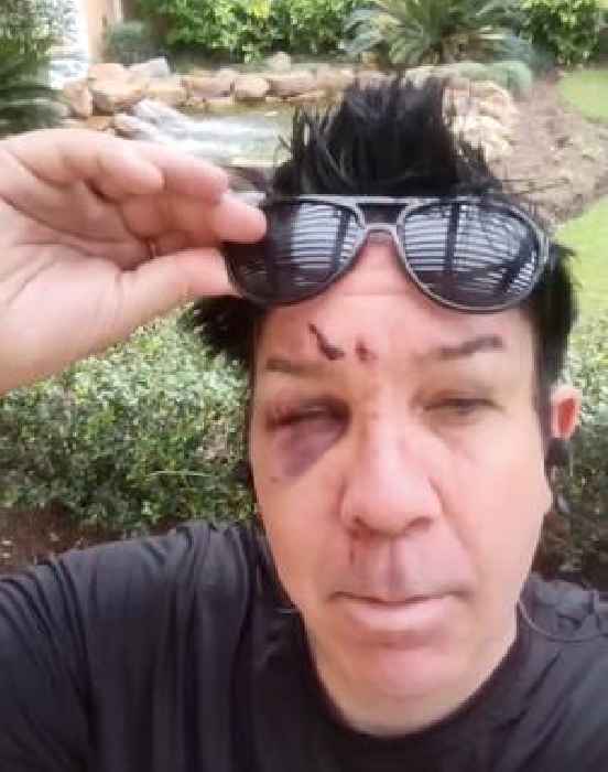 Crazy Town Singers Beat Each Other Up After Rocky Myrtle Beach Show