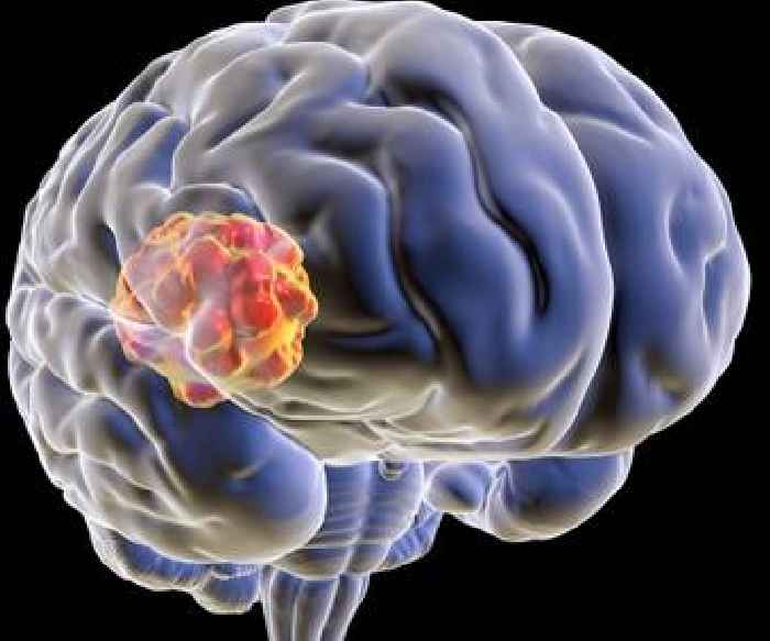Nevada reports cluster of rare brain infections in kids