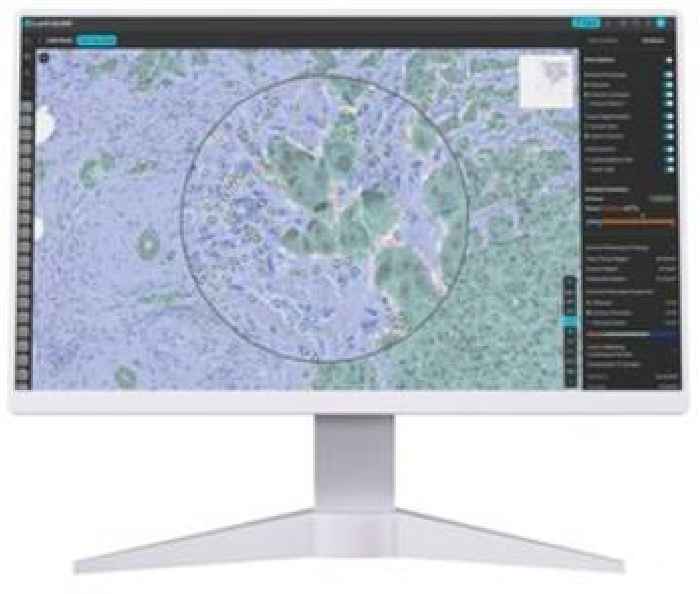 Lunit and the Japan National Cancer Center Hospital East Partner in AI Pathology to Advance Precision Oncology