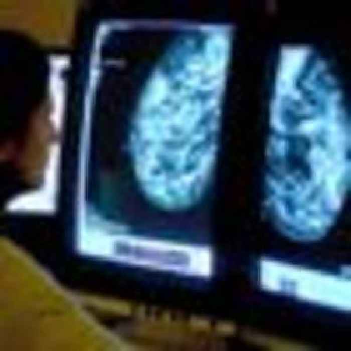 Cancer patients face worsening treatment delays due to lack of staff, report finds