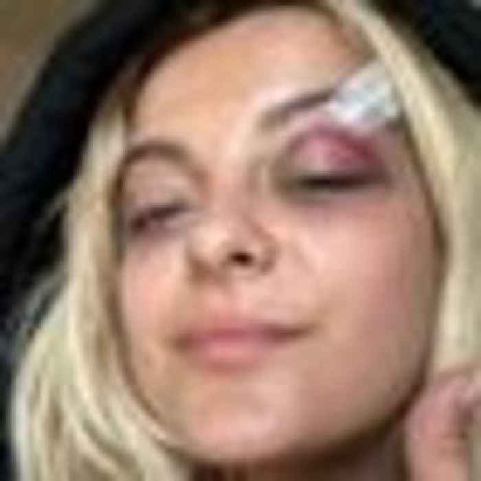 Bebe Rexha concert-goer threw phone at singer 'because it would be funny'