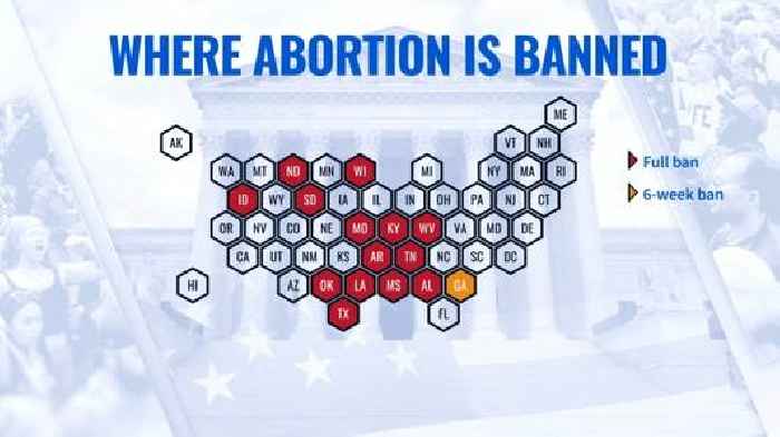 State of abortion laws: A year after Roe v. Wade overturned