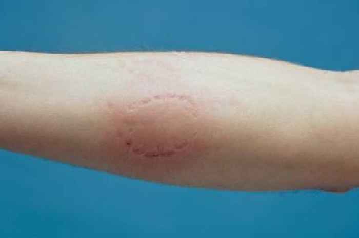 Grandmother begs judge not to jail Leicester man who bit cop on the arm