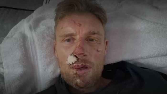 Freddie Flintoff reveals extent of injuries after Top Gear crash