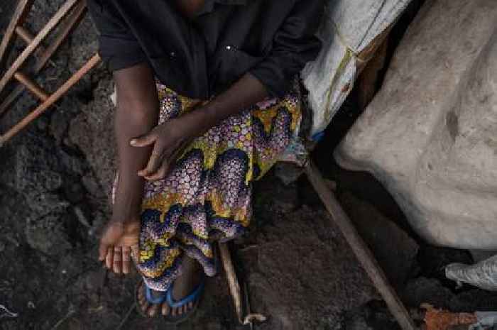 Man describes excruciating Mpox symptoms as new variant spreads