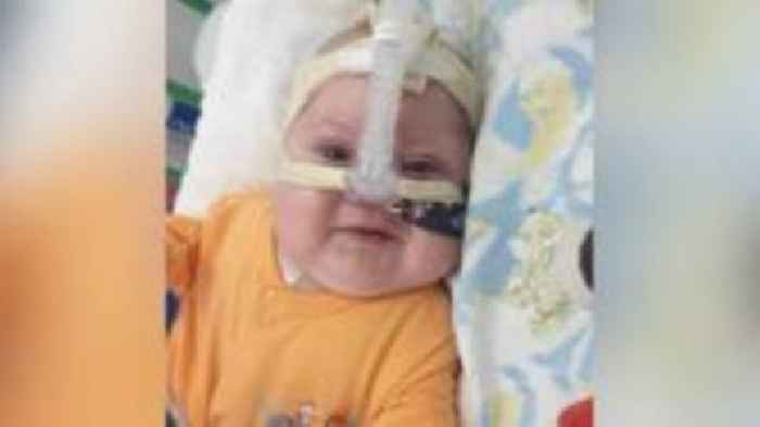 Doctors admit baby's brain damage was preventable