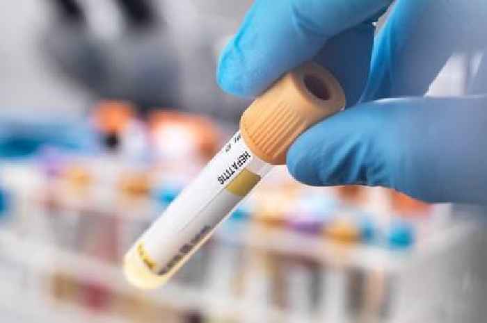 Hepatitis A confirmed among children in Scots town after local outbreak