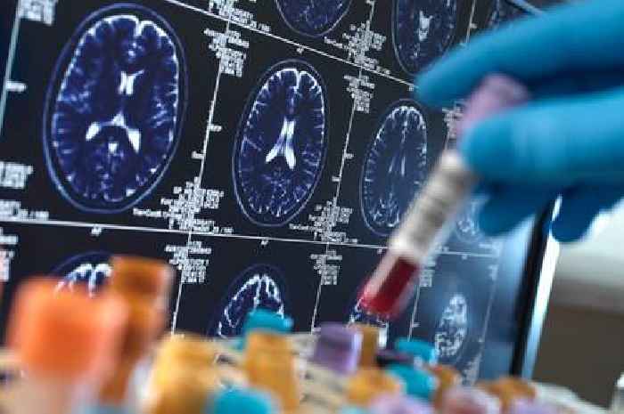 Dementia and Parkinson's 'cure' to be investigated in new first-of-its-kind research