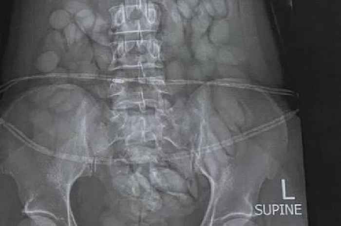 Woman arrested at airport in just seconds after staff take one look at X-ray