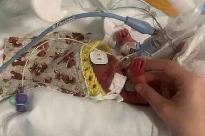 West Lothian mum 'terrified' as baby born three-months premature 'fights for life'