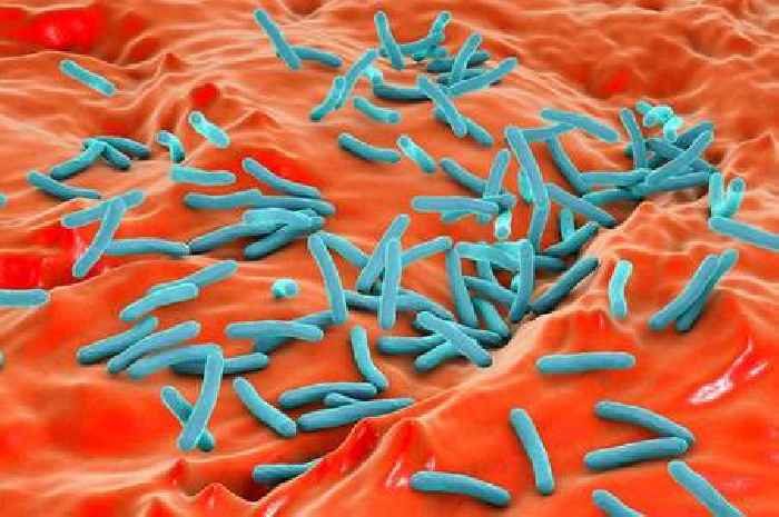 Tuberculosis in Scotland: Cases rise by 40% in one year