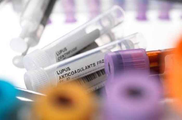 Red flag signs of rare condition affecting women as hopes grow of cure